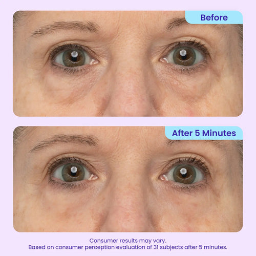 Alvorina™ Eye-Lifter