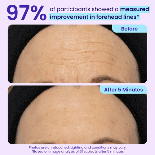 Alvorina™ Eye-Lifter