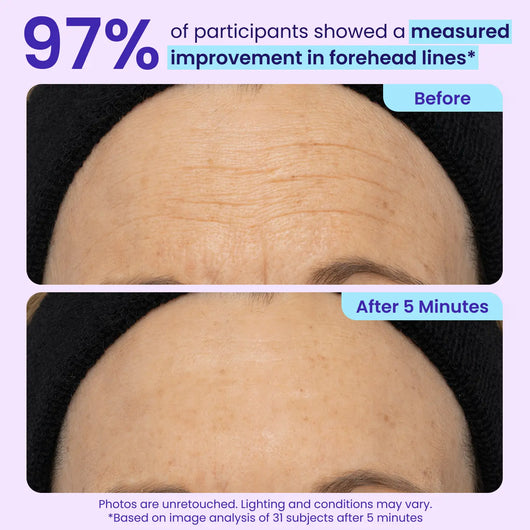 Alvorina™ Eye-Lifter